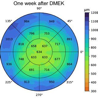 Example of pachymetry maps from one participant in the test set. (a ...