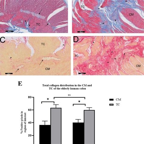 Quantification of total collagen fibres distribution in the Taenia coli ...