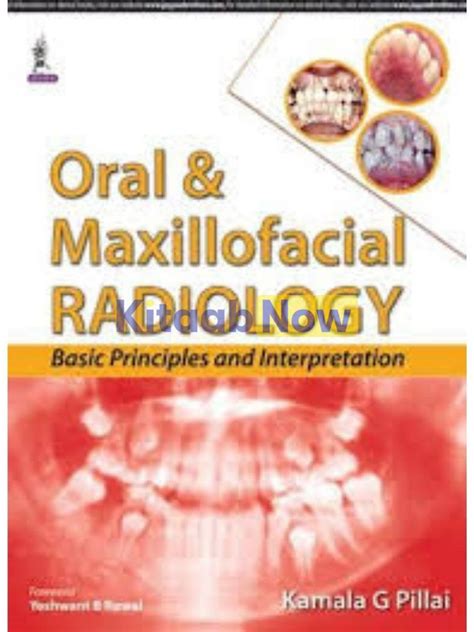 Oral and Maxillofacial Radiology: Basic Principles and Interpretation ...