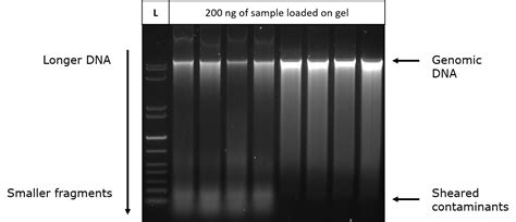 Gel Electrophoresis