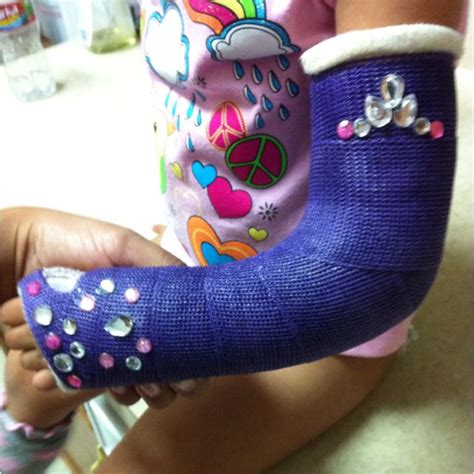 Decorate arm cast.. Arm cast bling for my princess.. just because i'm a grownup doesnt mean it's ...