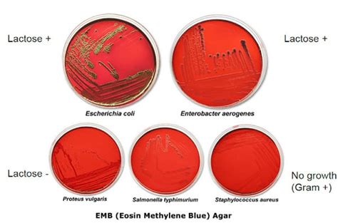 EMB (Eosin Methylene Blue) Agar - Plate, Composition and Results - Laboratoryinfo.com