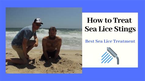 How to Treat Sea Lice Stings - Best Sea Lice Treatment - YouTube