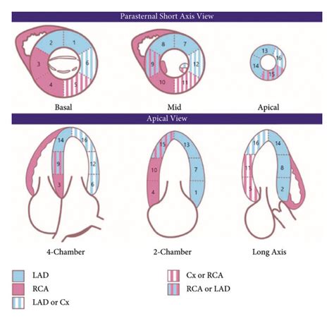 Wall motion scoring segmental analysis by transthoracic... | Download Scientific Diagram