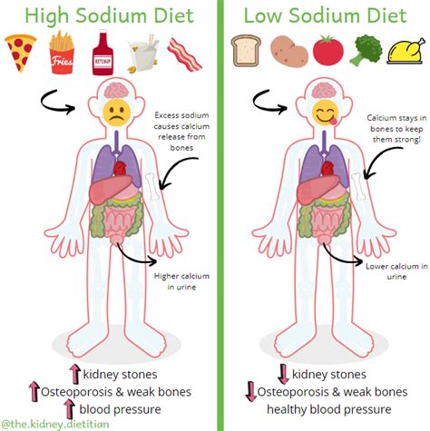 The Kidney Stone Diet: Nutrition to Prevent Calcium Oxalate Kidney ...