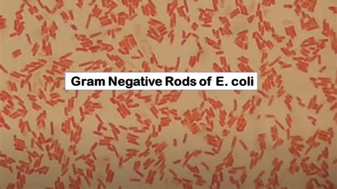 Gram Negative Rods E Coli