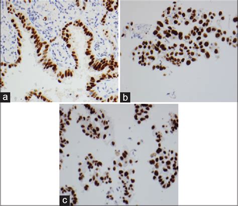 Validation of immunohistochemical tests performed on cytology cell ...