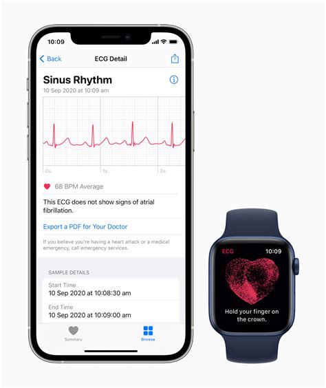 ECG app and irregular rhythm notification now available on Apple Watch ...