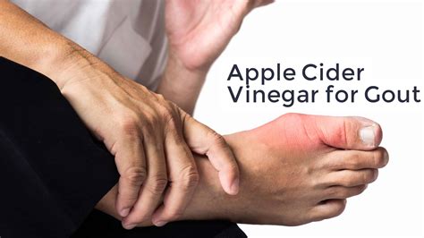 How to use Apple Cider Vinegar for Gout