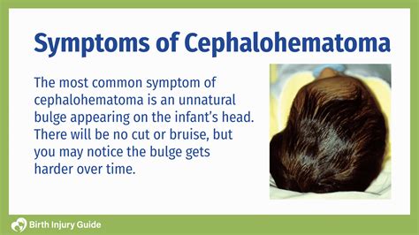 Cephalohematoma Ultrasound