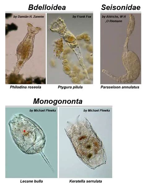 Facts about Rotifers – Amazing Microscopic Animals under the Microscope