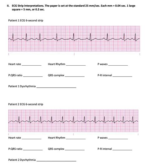 Free Printable Ekg Practice Test And Answers