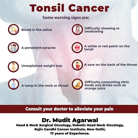 Tonsil Cancer Symptoms