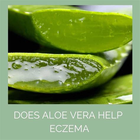 Does Aloe Vera Help Eczema? - Odylique