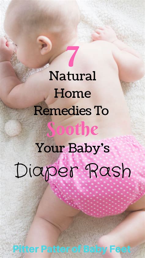 7 Natural Home Remedies To Soothe Your Baby's Diaper Rash | Baby diaper ...