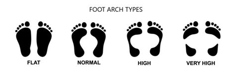 Foot Arch Types - auptimo