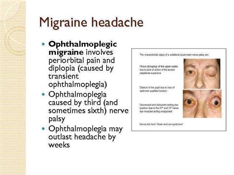 Health & Meditation: What Is Ophthalmoplegic Migraine?