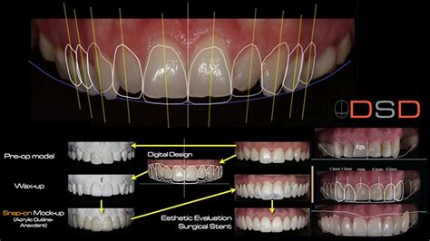 Digital Smile Design – Implantodontia, Ortodontia, Odontologia Estética e Digital