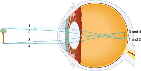 Physics of the Eye | Physics