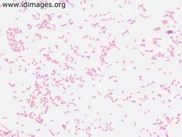 Bacteroides Images - Infectious Disease Images - eMicrobes Digital ...