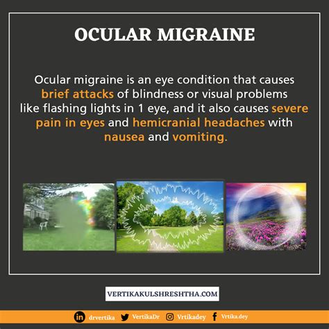 Ocular Migraine – Dr Vertika Kulshrestha | Eye Specialist