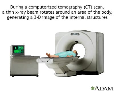 HIE Multimedia - Leg CT scan