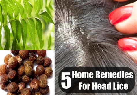 Head Lice Home Remedies, Treatments And Cures | USA, UK Herbal Supplements