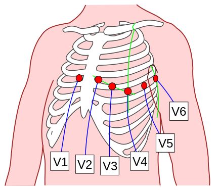 12 Lead ECG Placement