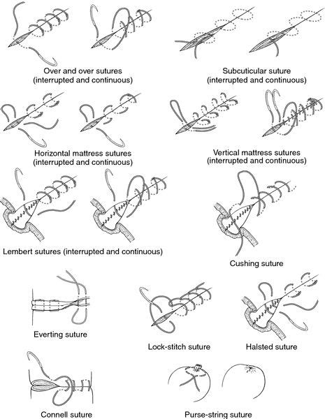 42 best Nursing (Stitches/Sutures) images on Pinterest