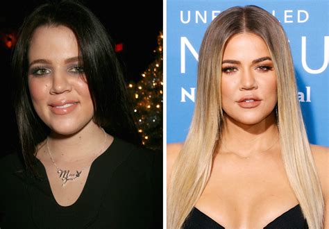 Kardashian Sisters: Who's Gotten the Most Surgery?