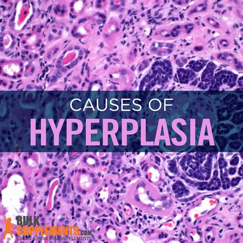 Hyperplasia: Symptoms, Causes & Treatment