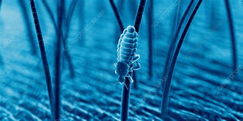 Head louse, illustration - Stock Image - F038/3276 - Science Photo Library