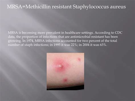 PPT - MRSA=Methicillin resistant Staphylococcus aureus PowerPoint ...