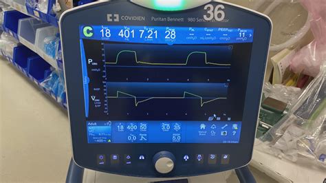 Regions Hospital tests new ventilator tech from Medtronic | kare11.com