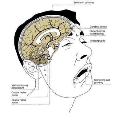 Health Effects - Strategies TO Prevent (STOP) Substance Abuse