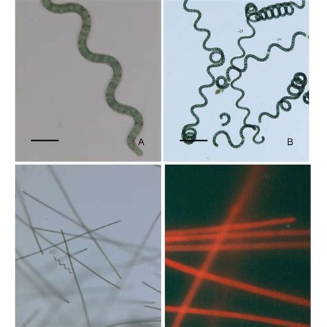 Arthrospira, transmission electron microscope. A: A. platensis grown in ...