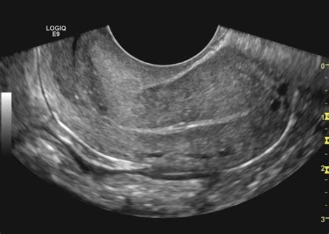 CP Advanced Imaging | Ultrasound