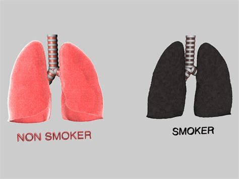 Smokers Lungs Vs Non Smokers Lungs