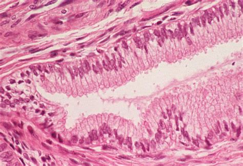 Basic Histology -- Mucin-Producing Columnar Epithelium