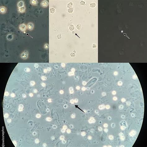 Lipid droplet within a loaded sediment. (Phase contrast bright field ...