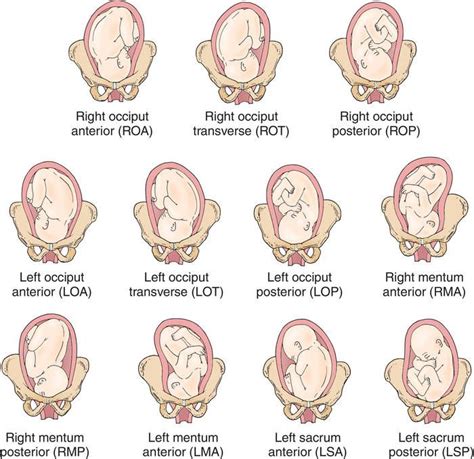 83 best images about Ob/Gyn 201 Mod 3 Ultrasound on Pinterest