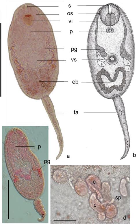 ﻿Cercarial dermatitis outbreak caused by ruminant parasite with intermediate snail host ...