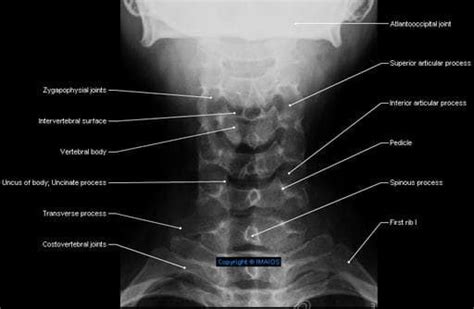 Pin on radiografias