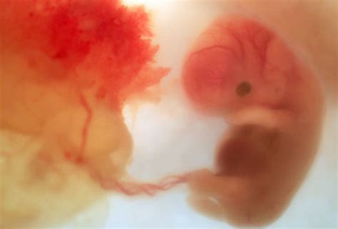 Development of a child inside the womb - HubPages