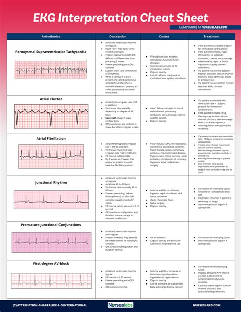 EKG Interpretation Cheat Sheet (Free Download) | Ekg interpretation cheat sheets, Ekg ...