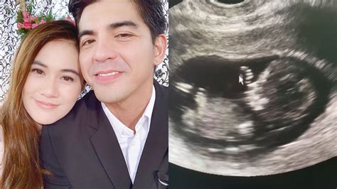 Mark Herras, girlfriend Nicole Donesa announce they're expecting | PEP.ph