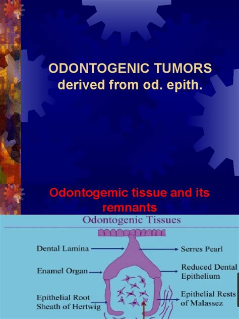 ODONTOGENIC TUMORS Lecture | PDF | Anatomy | Medical Specialties