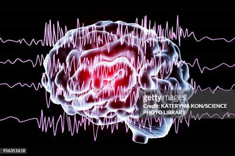 112 Epilepsy Brain Waves Stock Photos, High-Res Pictures, and Images - Getty Images