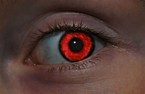 What is Red Eye and How Can You Prevent It?