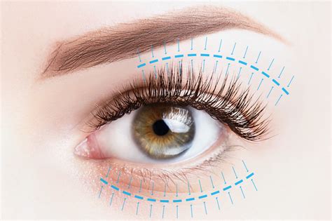 Best Laser Blepharoplasty Los Angeles & Beverly Hills, CA | Michael Omidi, MD